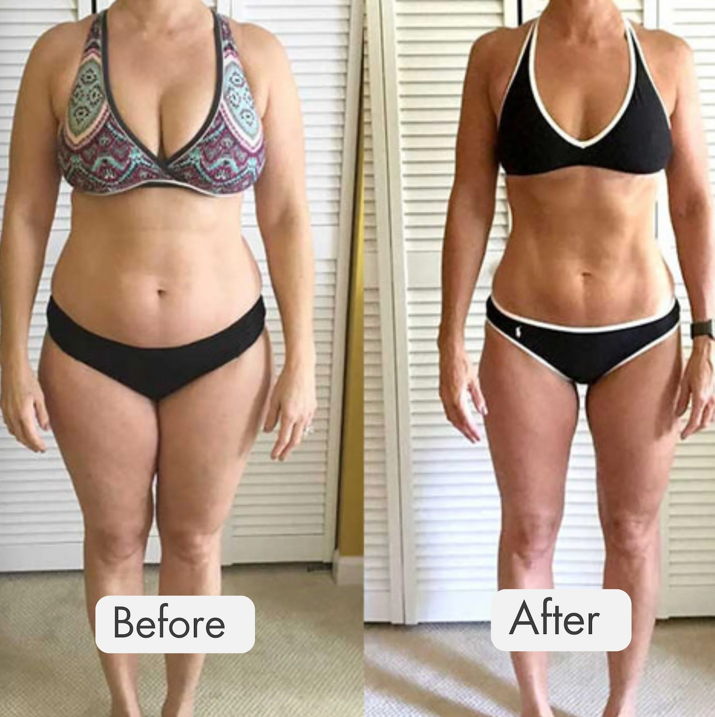 Pilates Reformer Set