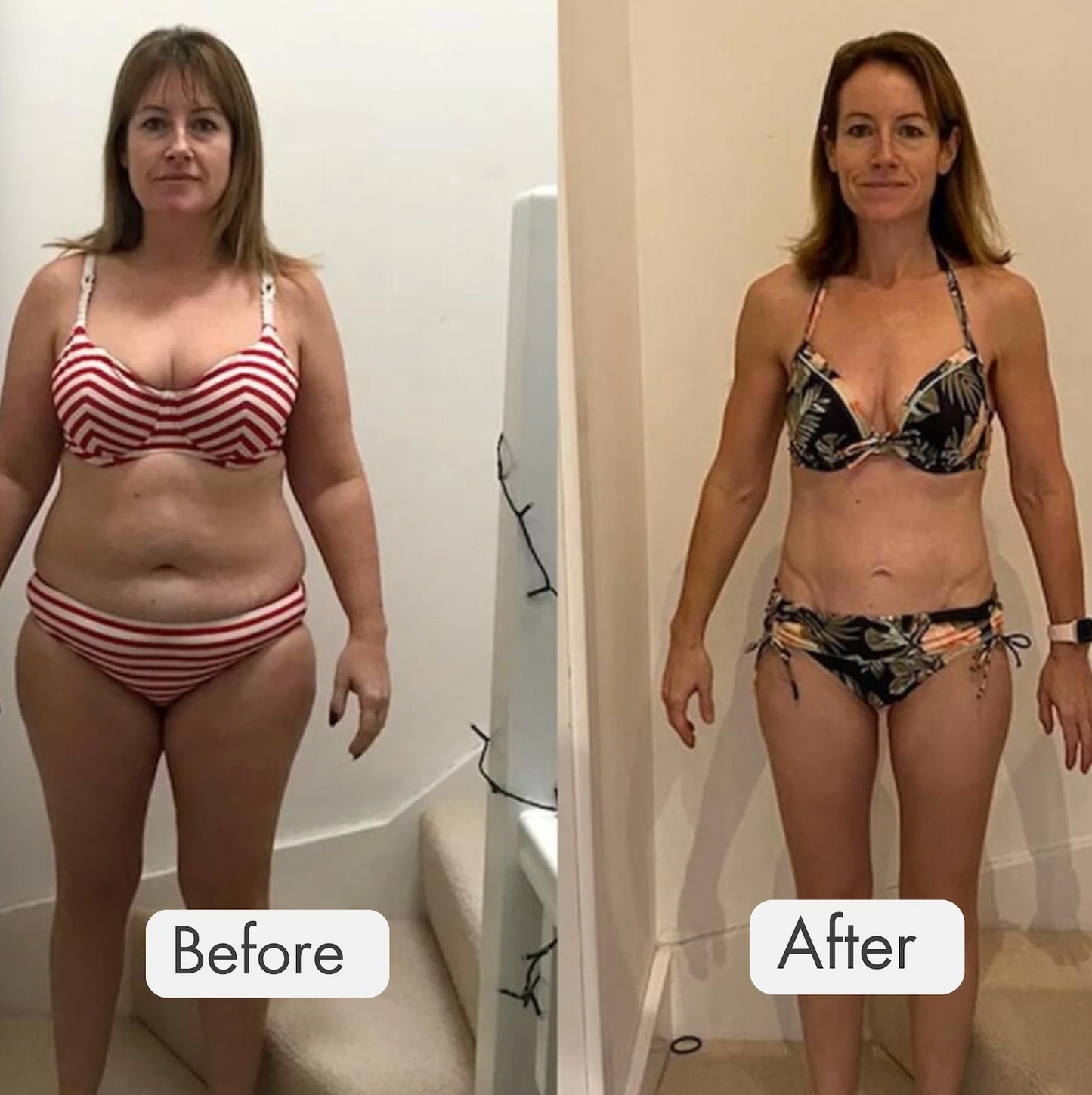 Pilates Reformer Set